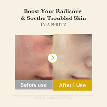 Load image into Gallery viewer, MEDICUBE Kojic Acid Termeric Vita Jelly Mist Serum 100ml