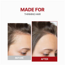 Load image into Gallery viewer, KUNDALHead Spa &amp; Scalp Care Scalp Tonic 100ml