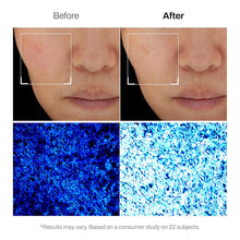 Load image into Gallery viewer, MEDITHERAPY Hyaluronic Acid First Skin Booster Serum 150ml