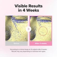 Load image into Gallery viewer, Beauty of Joseon Pore Firming Serum Red Bean PDRN+Peptide 30ml