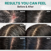Load image into Gallery viewer, lilyeve Scalp:Turn CICA PDRN Deep Clean Shampoo 500g