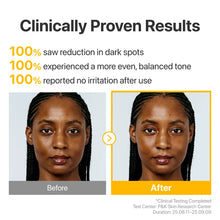 Load image into Gallery viewer, Numbuzin No.5 Glutathione TXA Advanced Dark Spot Ampoule Concentrate 10g+0.7g