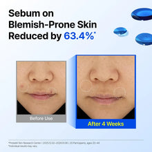 Load image into Gallery viewer, Klairs EGF Blue Youth Activating Drop 10ml