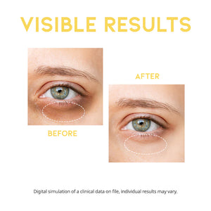 OOTD Dark Circle Eye Serum 30