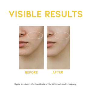 OOTD Dark Spot Vitamin C Serum 50ml