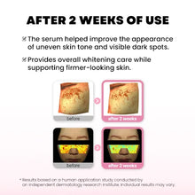 Load image into Gallery viewer, PRO-CALM Mela Whitening Lifting Serum 20ml