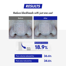 Load image into Gallery viewer, One-day&#39;s you No More Blackhead Pore Gel Cream 25ml