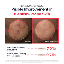 Load image into Gallery viewer, Sungboon Editor Red Heartleaf BHA-Lino Relief Ampoule 40ml