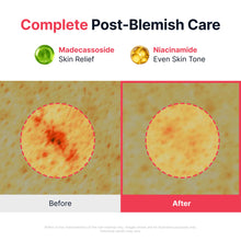 Load image into Gallery viewer, Sungboon Editor Red Heartleaf BHA-Lino Relief Ampoule 40ml