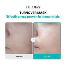Load image into Gallery viewer, REJURAN Turnover Mask 5EA