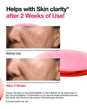 Load image into Gallery viewer, [1+1] Anua Niacinamide 10% + TXA 4% Dark Spot Correcting Serum 30ml
