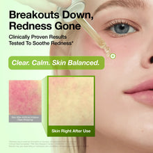 Load image into Gallery viewer, Anua Azelaic Acid 10 Hyaluron Redness Soothing Serum 30ml Double Pack