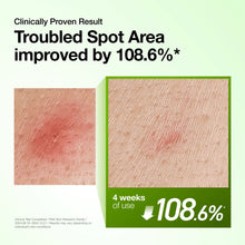 Load image into Gallery viewer, Anua Azelaic Acid 10 Hyaluron Redness Soothing Serum 30ml Double Pack