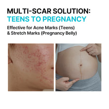 Load image into Gallery viewer, MILDLAB Scar Coat Gel 10g