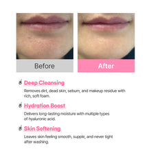 Load image into Gallery viewer, Hanskin Real Complexion Hyaluron Bubble Pop Cleanser 150ml