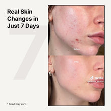 Load image into Gallery viewer, MILDLAB Centella Oint Cream 30g