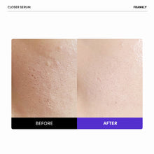 Load image into Gallery viewer, FRANKLY Closer Serum 30ml