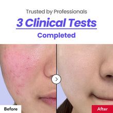 Load image into Gallery viewer, Dr.Percent Calming 64% Cream 30ml