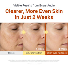 Load image into Gallery viewer, Sungboon Editor Kojic Acid Niacinamide Brightening Ampoule 40ml