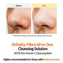 Load image into Gallery viewer, #OOTD Kiwi Vitamin C Cleansing Balm 100ml