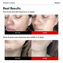 Load image into Gallery viewer, FRANKLY Retinol 0.1 Wrinkle Repair Cream 30ml Exp 2026 03 06
