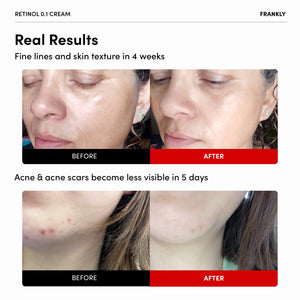 FRANKLY Retinol 0.1 Wrinkle Repair Cream 30ml Exp 2026 03 06