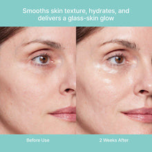 Load image into Gallery viewer, REJURAN Turnover Ampoule 30ml